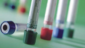 Kan Transfüzyonu Kan Transfüzyonu